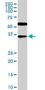 CDX4 Antibody in Western Blot (WB)