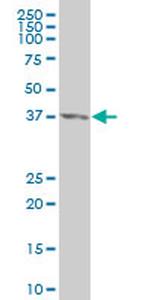 CDX4 Antibody in Western Blot (WB)