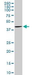 CDX4 Antibody in Western Blot (WB)