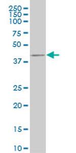 CDX4 Antibody in Western Blot (WB)