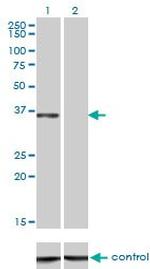 CEBPE Monoclonal Antibody (7A4)