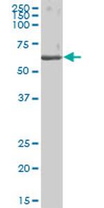 CES1 Antibody in Western Blot (WB)