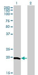 CETN1 Monoclonal Antibody (4C12)