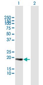 CETN3 Polyclonal Antibody, MaxPab™