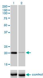 CETN3 Monoclonal Antibody (3E6)