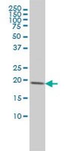 CETN3 Antibody in Western Blot (WB)