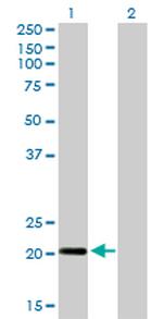 CETN3 Antibody in Western Blot (WB)