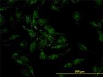 CFL2 Monoclonal Antibody (6G9)