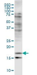 CFL2 Antibody in Western Blot (WB)