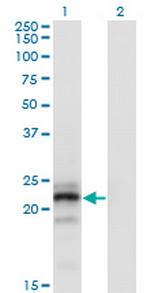 CGB Antibody in Western Blot (WB)