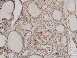 RCC1 Antibody in Immunohistochemistry (Paraffin) (IHC (P))