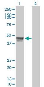 RCC1 Antibody in Western Blot (WB)