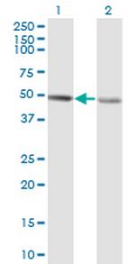 RCC1 Monoclonal Antibody (1C1)