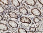CHD3 Antibody in Immunohistochemistry (Paraffin) (IHC (P))