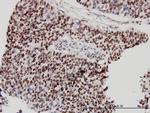 CHD4 Monoclonal Antibody (4H4)