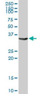 AKR1C4 Antibody in Western Blot (WB)