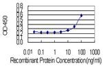 AKR1C4 Antibody in ELISA (ELISA)