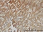 AKR1C4 Antibody in Immunohistochemistry (Paraffin) (IHC (P))