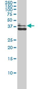 AKR1C4 Antibody in Western Blot (WB)