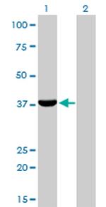 AKR1C4 Antibody in Western Blot (WB)