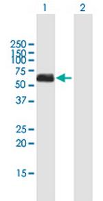 CHEK1 Antibody in Western Blot (WB)