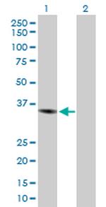CHI3L1 Polyclonal Antibody, MaxPab™