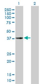 CHI3L2 Polyclonal Antibody, MaxPab™