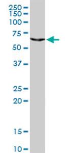 CHML Antibody in Western Blot (WB)