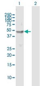CHN1 Polyclonal Antibody, MaxPab™
