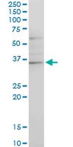 CHN1 Antibody in Western Blot (WB)