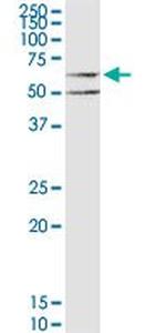 CHRM3 Antibody in Western Blot (WB)