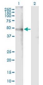 CHRNA4 Polyclonal Antibody, MaxPab™