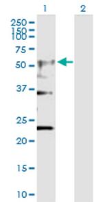 CHRNA4 Polyclonal Antibody, MaxPab™