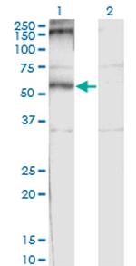 CHRND Monoclonal Antibody (2B2)