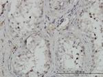 CHUK Antibody in Immunohistochemistry (Paraffin) (IHC (P))