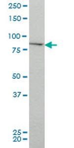 CHUK Antibody in Western Blot (WB)