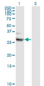 CIDEA Monoclonal Antibody (4B9)