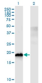 CIRBP Antibody in Western Blot (WB)