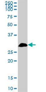 TBCB Polyclonal Antibody, MaxPab™