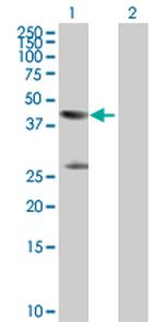 CKM Polyclonal Antibody, MaxPab™