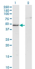 CKM Monoclonal Antibody (3E1-F3)