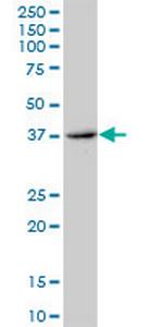 ERCC8 Polyclonal Antibody, MaxPab™