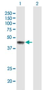 ERCC8 Antibody in Western Blot (WB)