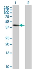 ERCC8 Polyclonal Antibody, MaxPab™