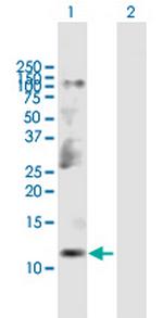 CKS2 Polyclonal Antibody, MaxPab™