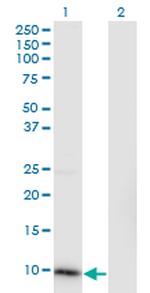 CKS2 Antibody in Western Blot (WB)