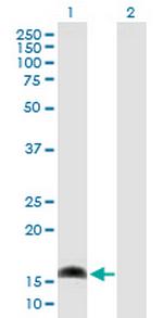 AP1S1 Antibody in Western Blot (WB)