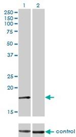 AP2S1 Antibody in Western Blot (WB)