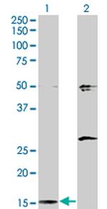 AP2S1 Antibody in Western Blot (WB)