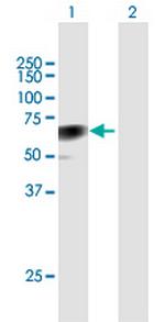 CLU Antibody in Western Blot (WB)